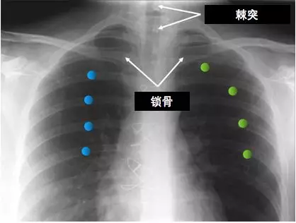 图片11.png